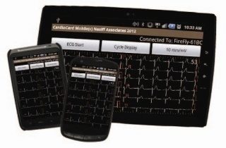 ekg ekg
