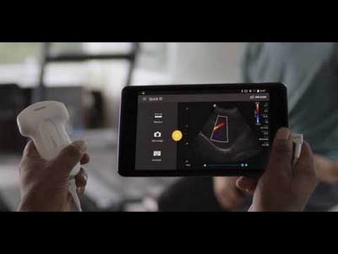 Philips Lumify - Ultrasound on your compatible smart device