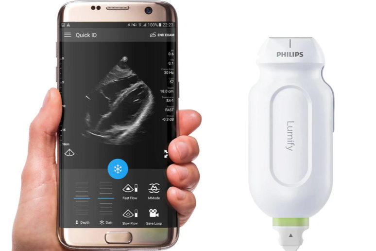 philips lumify ultrazvuk philips lumify ultrazvuk