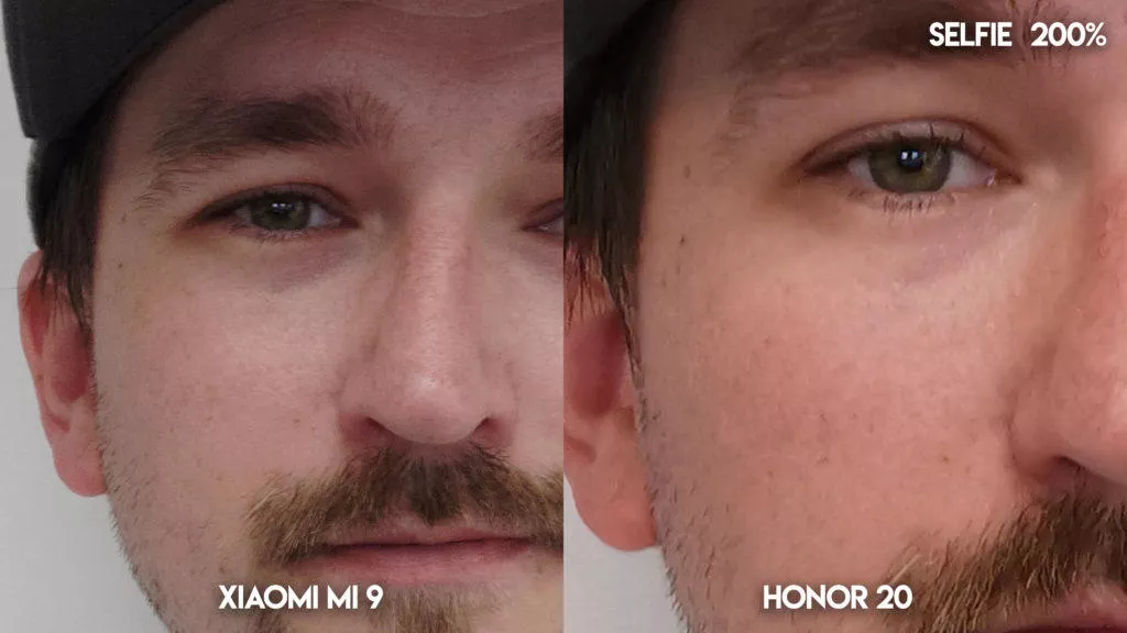 Fototest Xiaomi Mi 9 vs Honor 20 selfie detail