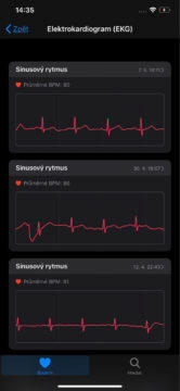 Záznamy EKG z chytrých hodinek