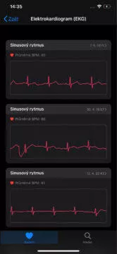 Záznamy EKG z chytrých hodinek