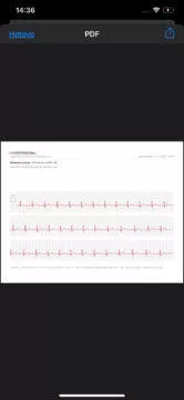 Export záznamu EKG - chytré hodinky