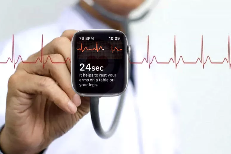 chytré hodinky ekg chytré hodinky ekg