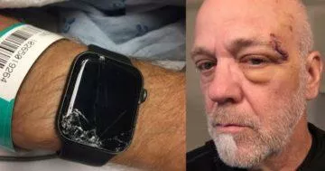 apple watch chytré hodinky detekce pádu apple watch chytré hodinky detekce pádu