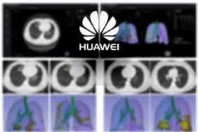 umělá inteligence Huawei koronavirus