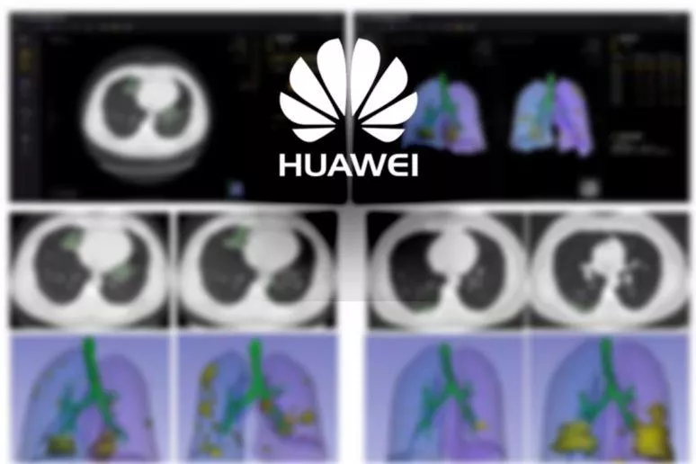 umělá inteligence Huawei koronavirus umělá inteligence Huawei koronavirus