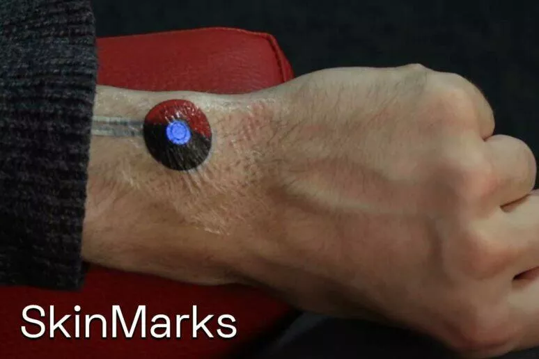 SkinMarks Google SkinMarks Google
