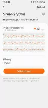 Samsung Health Monitor 8 EKG graf