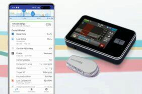 mobil dávkovač inzulínu aplikace t connect t slim x2