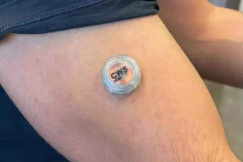 laborka na paži senzor glukóza alkohol laktát laborka na paži senzor glukóza alkohol laktát