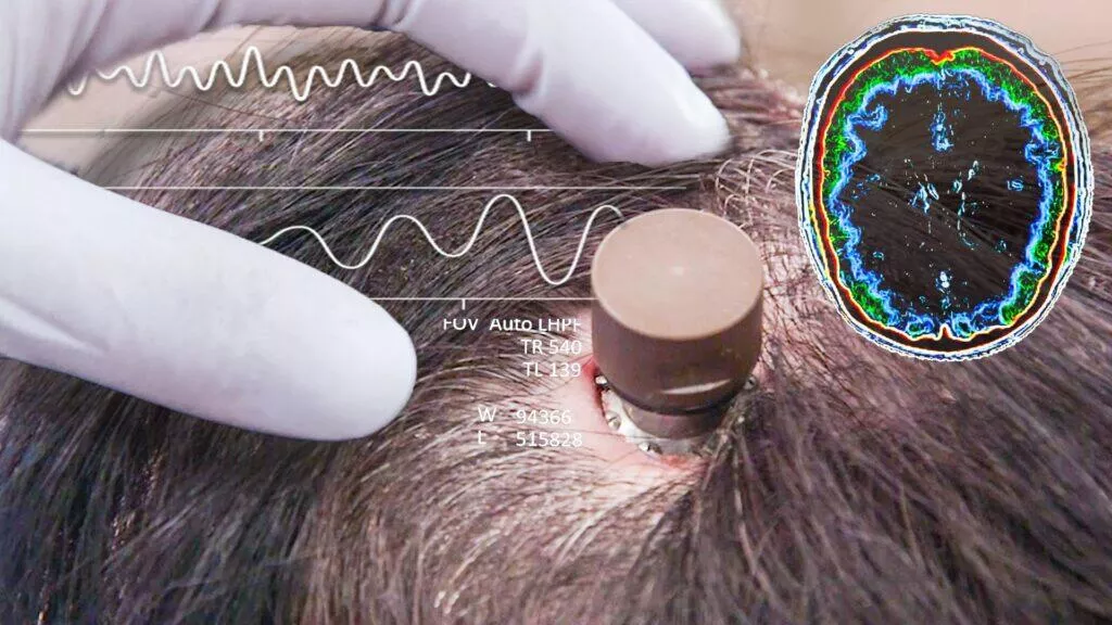 neuralink čip